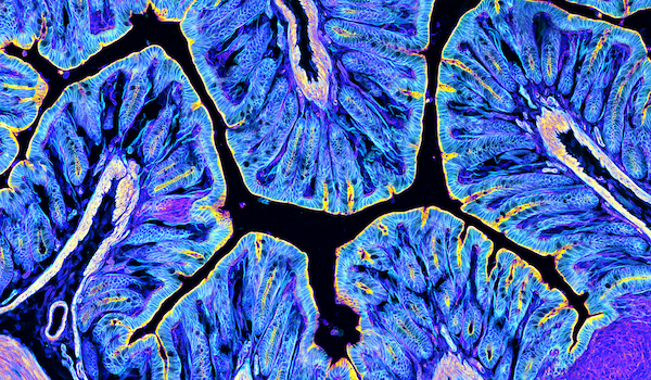 YCharOS IF Research Antibody Validation 