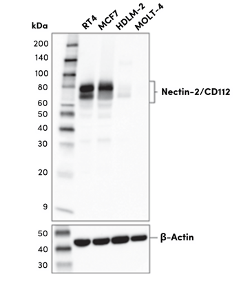 Nectin-2_CD112 Orthogonal Antibody Validation Western Blot