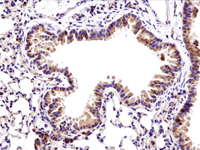 Immunohistochemical analysis of paraffin-embedded mouse lung using recombinant monoclonal antibody Bax (D3R2M) Rabbit mAb #14796.