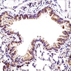 IHC Bax Monoclonal Antibody_square