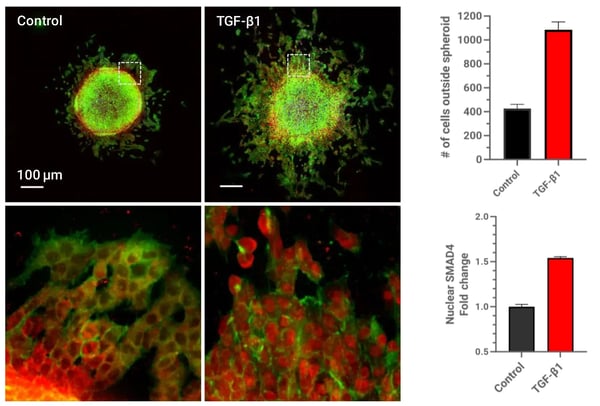 A549 spheroids analyzed using CST total SMAD4 antibody from CST