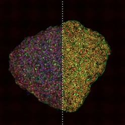 Scaffold-free, suspension-cultured spheroid analyzed using CST monoclonal antibody toS MAD2/3.