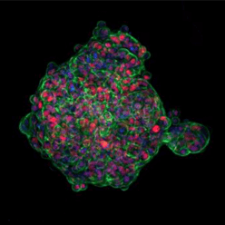 Matrix-embedded 3D spheroid model seeded in collagen and analyzed using CST monoclonal antibody to Phospho-SMAD2 (Ser465/Ser467).