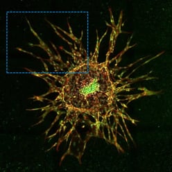 D sprouting angiogenesis spheroid grown in a fibrinogen matrix and analyzed using CST recombinant monoclonal antibody to SMAD4.