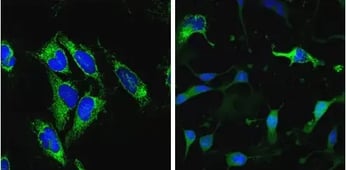 IF analysis of cells using Smac/Diablo antibody Z-VAD