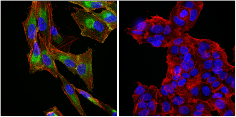 IF analysis using ACSL4 antibody, a ferroptosis marker