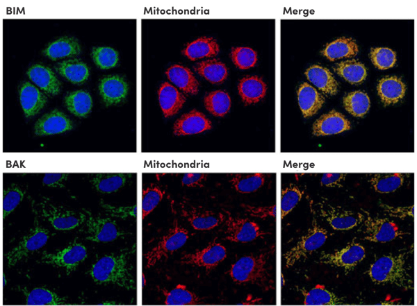 IF analysis of BIM and BAK co-localization with mitochondria, an apoptosis marker