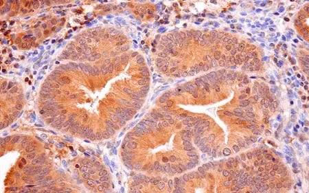 8873_casp8 antibody_uterine cancer_small