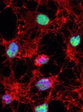 9929_Cleaved PARP antibody_Thumbnail