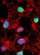9929_Cleaved PARP antibody_Thumbnail