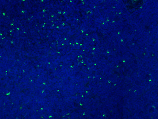 IHC analysis of B-cell non-Hodgkin lymphoma Granzyme B antibody
