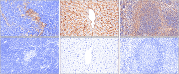 IHC analysis of thymus, liver, and spleen using beta2-microglobulin antibody and knockout tissue