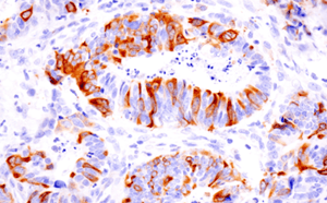 61976_IHC_Cyclin B1 antibody replication errors