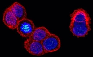 94244_IHC bub1 antibody Mitotic Spindle Checkpoint protein