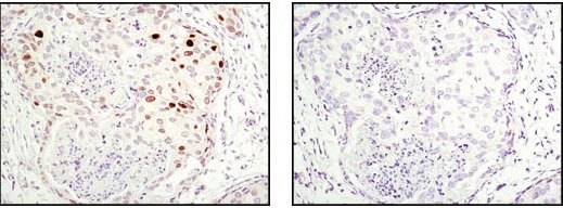 Checkppint protein_IHC p21 antibody breast cancer_2947