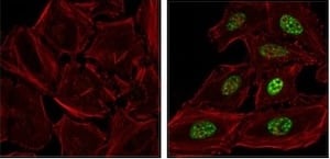 DNA Replication Stress IF phospho-Chk1 antibody_12302-1