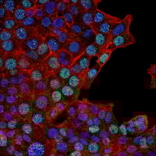 Homologous recombination immunofluorescence Rad51 antibody colorectal cance_65653 