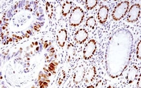 Mismatch Repair IHC MSH6 antibody_78576