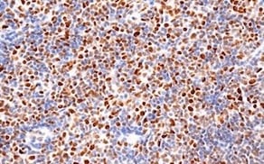 Mismatch Repair IHC PMS2 M0R4G_12988