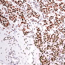 NHEJ IHC DNA-PKcs antibody breast cancer_38168