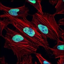 NHEJ_immunofluoresence Ku80 antibody_2180