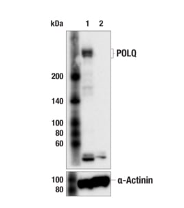 TMEJ Western blot DNA Polymerase theta POLQ antubody_64798
