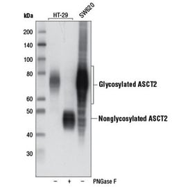 Tumor Glutamine Metabolism: Western blot analysis of human colon and colorectal cancers using ASCT2 recombinant monoclonal antibody.
