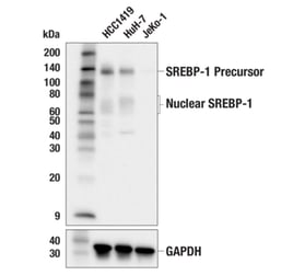 Lipid metabolism: Western blot analysis of human cancer cell lines using SREBP-1 recombinant monoclonal antibody