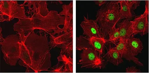 IF analysis of HepG2 cells (human liver cancer cell line), untreated or treated with cobalt chloride, using HIF-1α recombinant monoclonal antibody. 