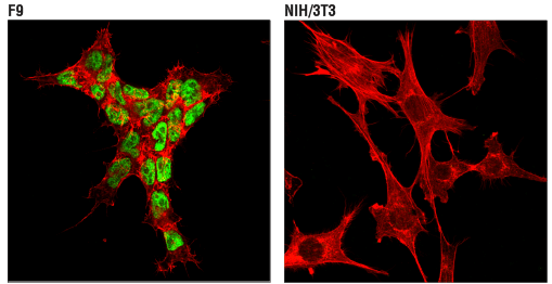 DNA Erasers: IF analysis using TET2 antibody