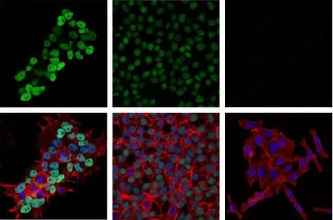 DNA writers: IF analysis using DNMT3B antibody