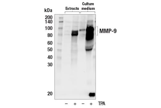 13667_WB analysis of MMP9 antibody