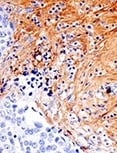 26836_IHC analysis using Fibronectin antibody_thumbnail