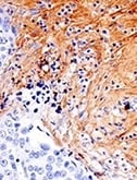 26836_IHC analysis using Fibronectin antibody_thumbnail