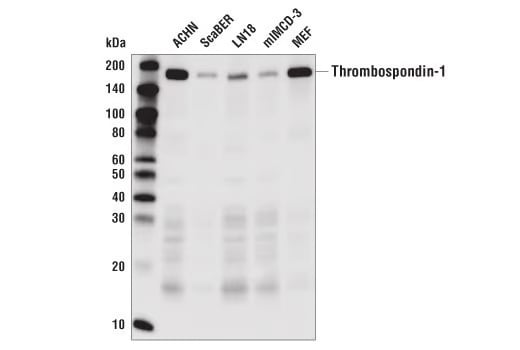 37879_WB analysis thrombospodin-1 antibody
