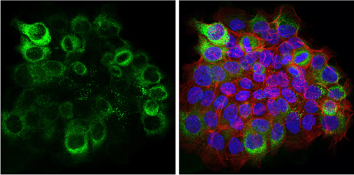 IF analysis of LAMC2, and ECM TME marker of the TME, in A-431 cells