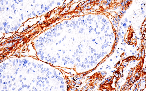 66948_IHC analysis using COL1A1 monoclonal antibody_small