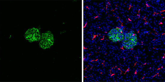 IF analysis of mouse kidney using vimentin antibody