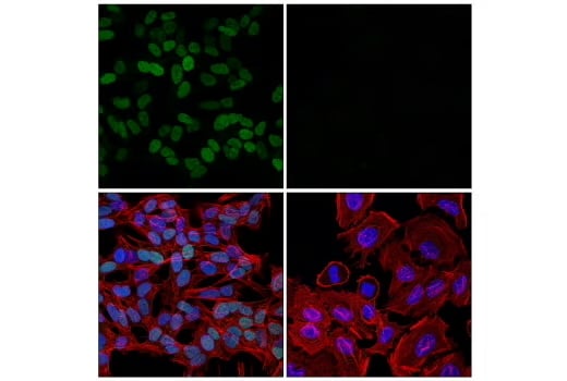 IF analysis using TWIST1 antibody, an EMT regulator