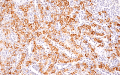 24326_IHC analysis using CD16 antibody