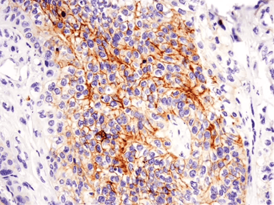37805_IHC analysis using CD117c-kit antibody