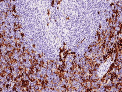 97585_IHC analysis using CD11c