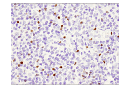 98377_IHC analysis of regulatory T cells using FoxP3