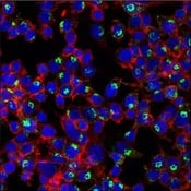 11948_IF TNF-alpha antibody copy