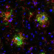 17800_IF CD11b antibody alzheimers mouse model