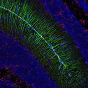 5741_Vimentin monoclonal antibody