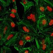 9139_IF Stat3 antibody