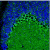 95730_ALDH1L1 chimeric antibody-1