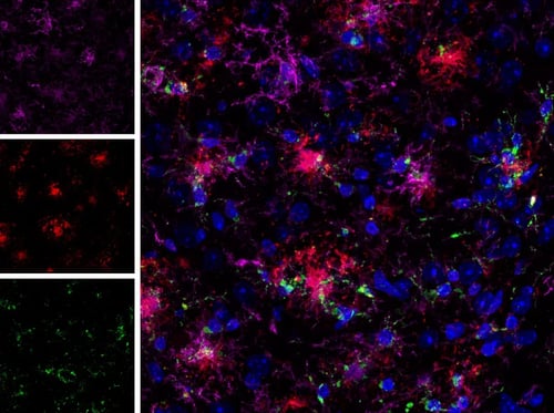 IF analysis of fixed frozen brain from an amyloid mouse model of Alzheimer's disease using chimeric antibodies targeting CD68 and TMEM119