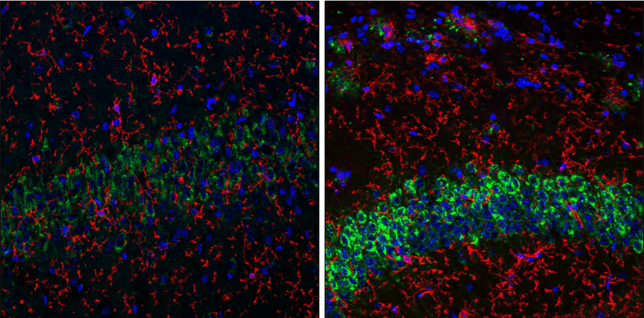 IF analysis of mouse Hippocampus using amyloid-beta precursor protein (APP) monoclonal antibody an Alzheimer's disease biomarker
